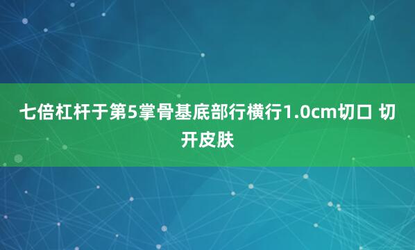 七倍杠杆于第5掌骨基底部行横行1.0cm切口 切开皮肤